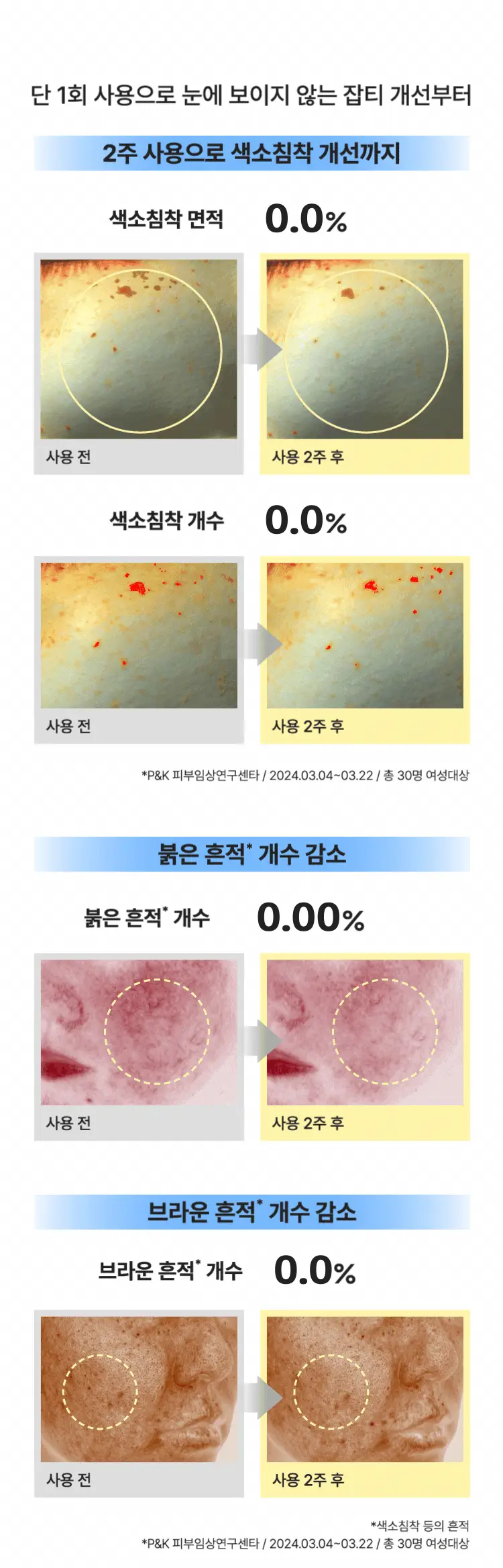 [화해1등/흔적진정] 마몽드 카밍 샷 아줄렌 흔적 수분앰플 50ml 기획 상세페이지 9